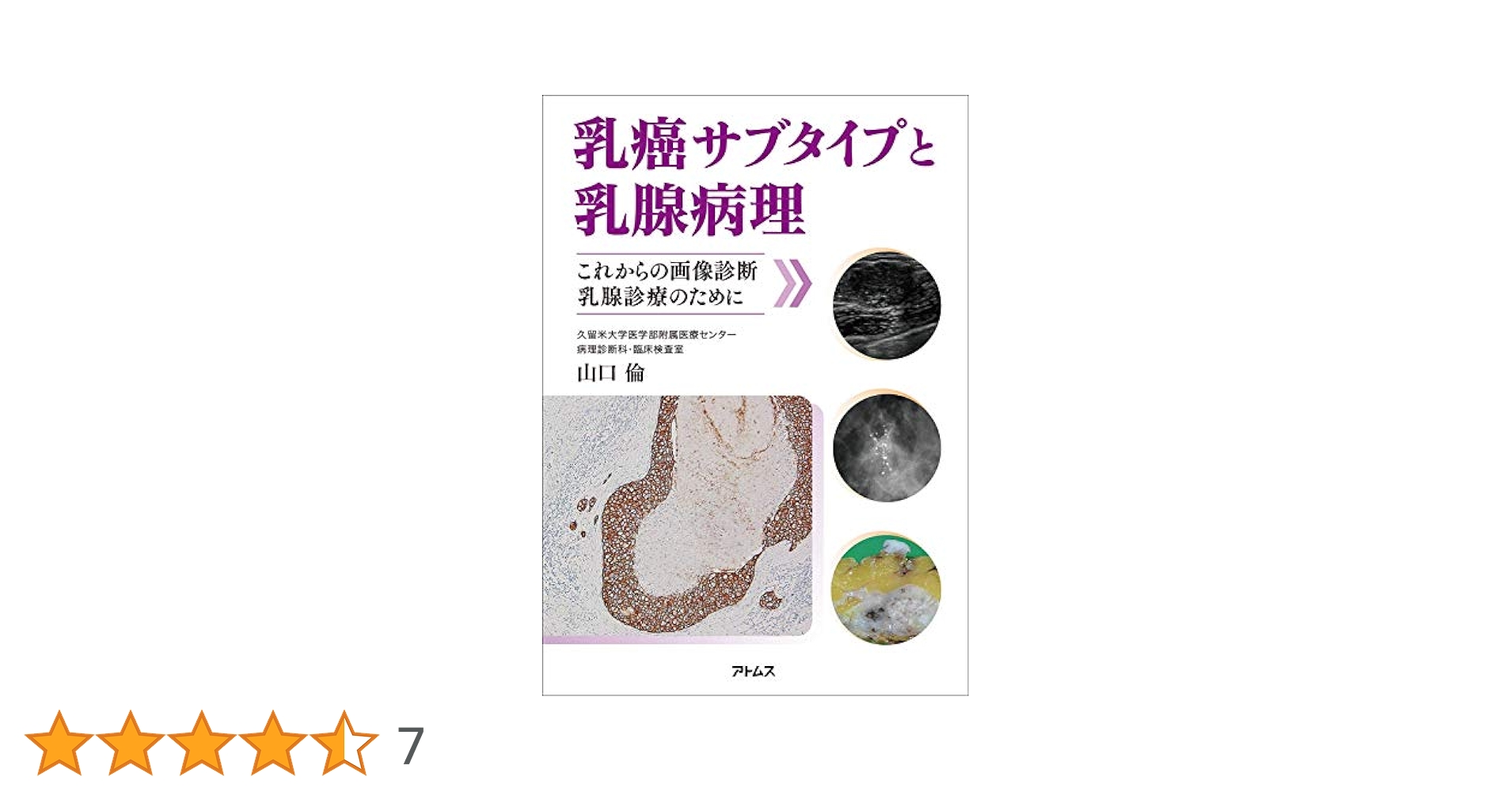 乳癌サブタイプと乳腺病理 -これからの画像診断、乳腺診療のため