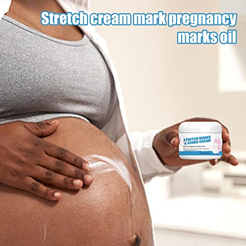 Estrias para Gravidez - Conjunto Estrias para Maternida, Hidratante e Rico em Fórmula Natural Alta P