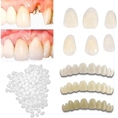 Fake Tooth Repair Kits DIY Dental Care Kit Glue for Filling Missing Broken Teeth Crowns and Bridges Moldable Fake Teeth to Regain Your Beautiful Smile in Minutes-White Color Cover