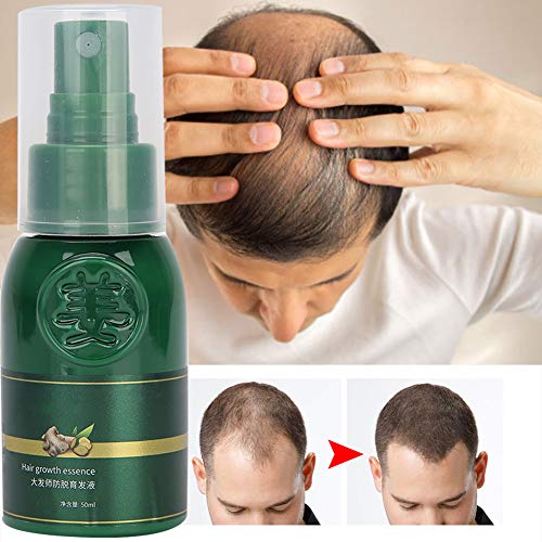 Spray per la crescita dei capelli, olio siero per