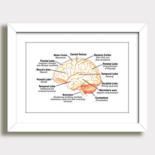 Quadro Medicina Anatomia Cerebro Humano Medico Decorativo Clinica Hospital Consultorio Moldura e Pas