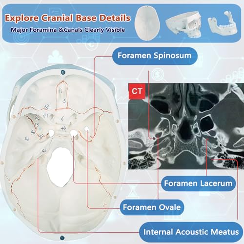 Image of Numbered Human Skull Model,White Human Anatomy Exploded Skull,3 Parts and 55pcs Labeled Numbered for Student Study,Teaching Demonstration and Medical Education Display