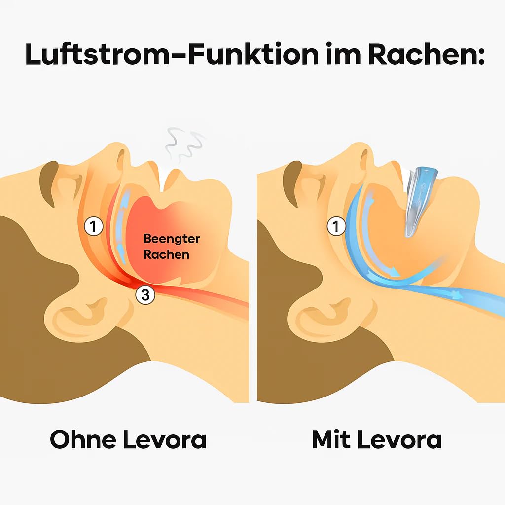 Levora Anti-Achnarch-Achiene Knirscherschiene,wiederverwendbare Schlafhilfe (2PCS)