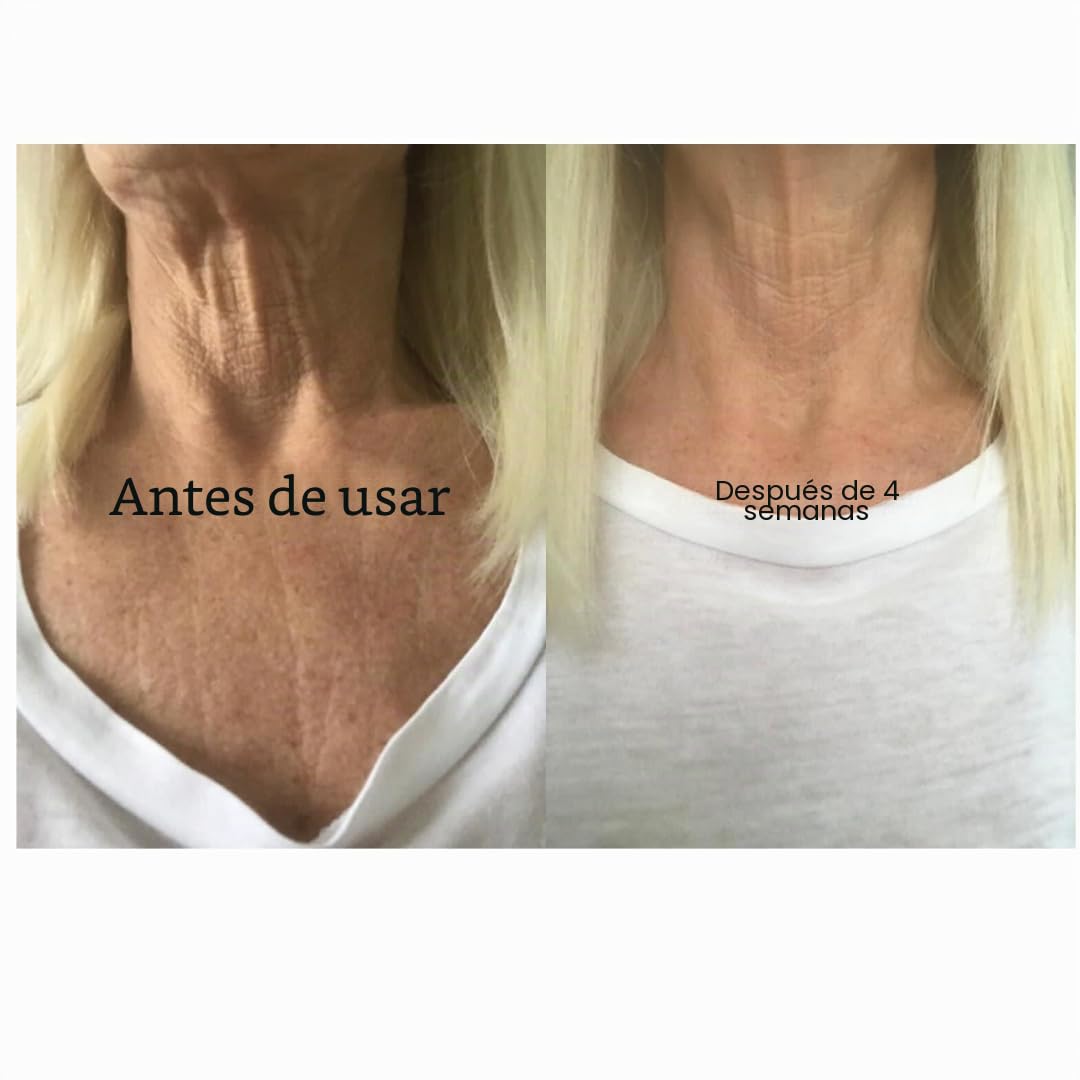 SkinRèmide Parches Antiarrugas de Silicona para alisar el escote