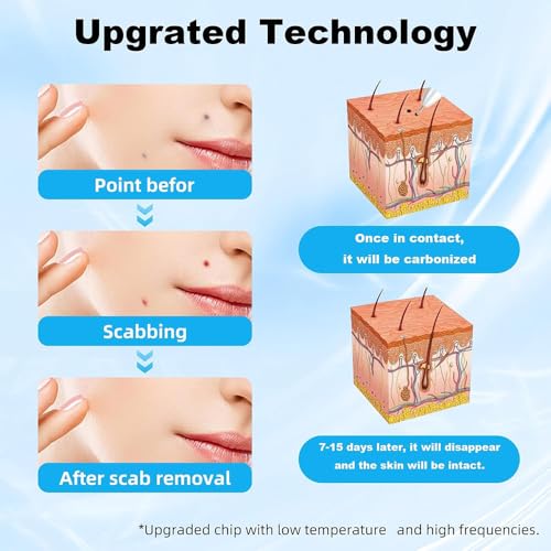 Kit profissional de remoção de pele, caneta de remoção de etiqueta de pele, ajuste de 12 níveis, com