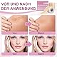 Silikon-Narbenpflaster, Silikon Narben Tape, Atmungsaktive Silikon Narbenband, Silikon Narbenblätter, Medizinisches Narbenband Mit Kollagen, Für Operationen, Kaiserschnitt, Bauchdeckenstraffung