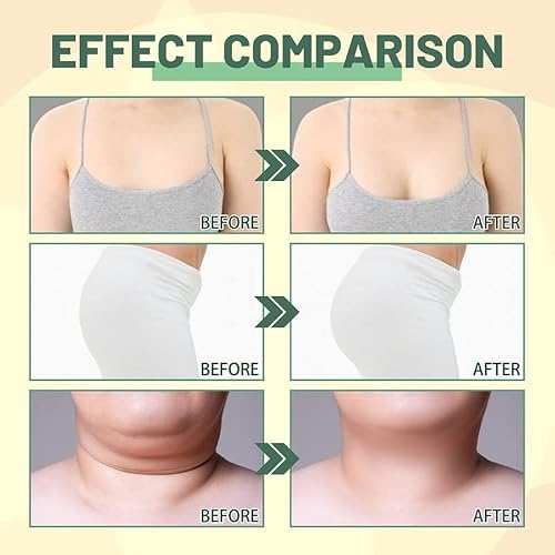 Evni Beauty Lady Collagen Lifting Body Oil, Flysmus Beauty Women Collagen Lifting Body Oil, Anti Aging Collagen Serum For Face, Reduces Fine Lines & Wrinkles (Color : 2Pcs) #TOP3