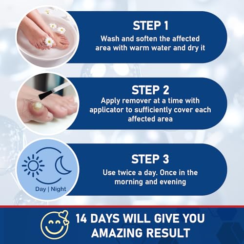 Image of inchSTAY STOKED inch Wart Remover, 15ml Liquid Wart Freeze Off - Salicylic Acid Formula with Brush Applicator-QQ1