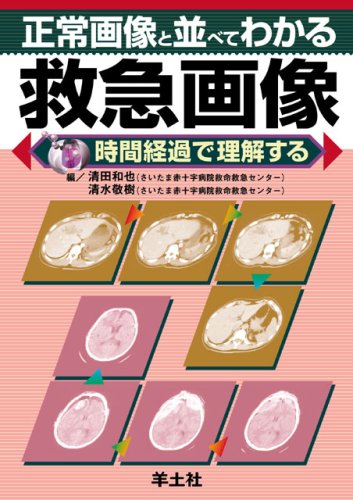 スマホ 無料電子書籍 正常画像と並べてわかる救急画像―時間経過で理解する バイ