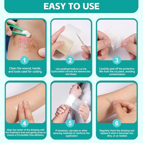 New Version Hydrocolloid Roll,2in*16ft Hydrocolloid Bandages for Wound Care,Medical-Grade Hydrocolloid Patch Bandages with Self-Adhesive, Flexible & Waterproof DIY Size & Shape (16FT) — view 6