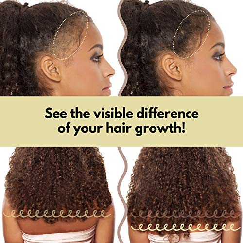 image for mimosu Natural Hair Growth Conditioner DIY Kit, Rice Water for Hair Gr