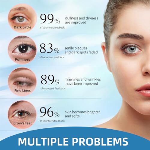 Allony Instant Eye Cream Tightener, Eye Tightening Cream Instant, Tightening Eye Cream, Eye Wrinkle Cream Iinstant Results, 30ml*2 - Image 6