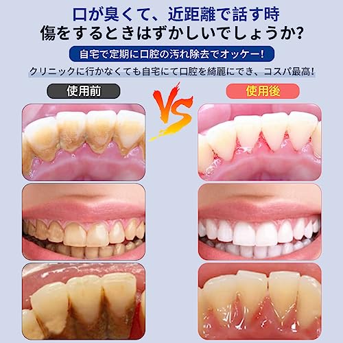 YOUMAY 歯クリーナ YM-WH03 の商品画像 2