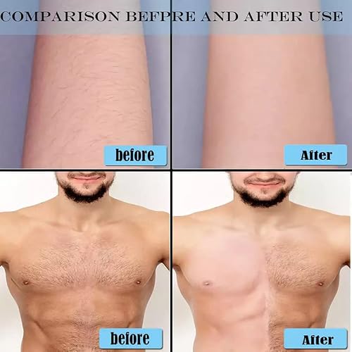 Laser Hair Removal for Men, Permanent Painless IPL Hair Removal Device for women With 999,900 Flashes,Auto and manual Mode,5 Levels,Hair Remover Used for Back,Legs Arms Bikini(Black) - Thumbnail 6