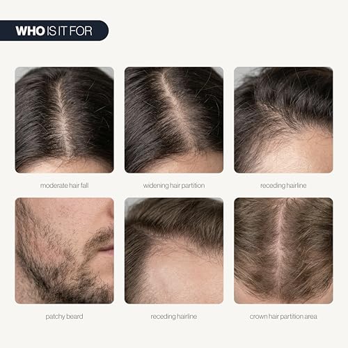 Be Bodywise Hair Growth Serum Roll-On – Saw Palmetto & Rosemary, 0.84 oz — view 3