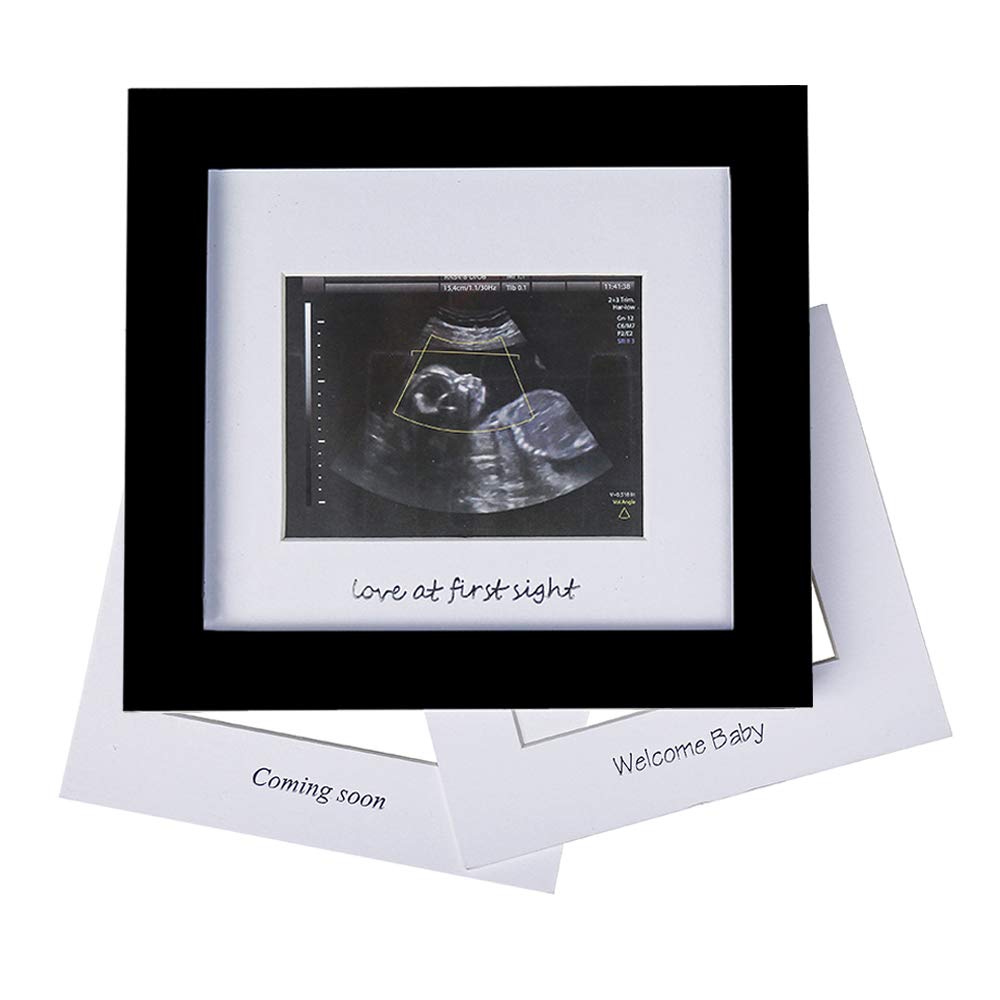 Baby Sonogram Photo Frame 1st Ultrasound Picture Frame