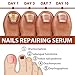 Rednow Gfouk 7 Days Nail Growth and Strengthening Serum Nail, Repair Essence, Cuticle Oil Strengthener, Solution, for Damaged Nails(2pcs), 2.0 Fl Oz