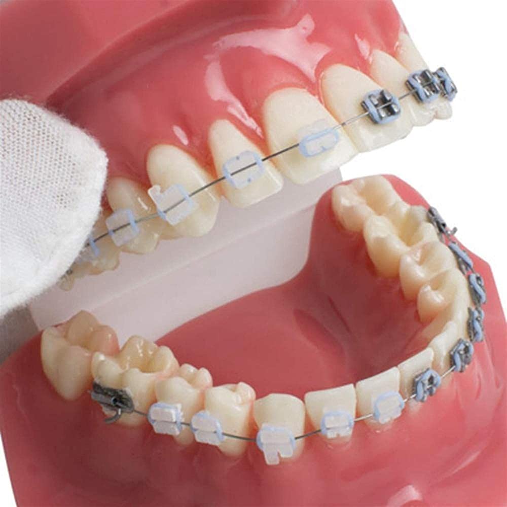 NaoSIn-Ni Model do nauki model zębów dentystyczne malokluzja ortodontyczne leczenie l nauka zębów do nauki 1 szt. medyczne narzędzie do nauki zabawka