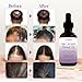 Rosemary Oil With Black Castor, Batana, Lavender, Coffee, Coconut, Argan, Avocado, Olive, Almond & Parsley Seed Oil, 11 Oils Infused for Ultimate Hair Growth & Care for Stronger, Thicker Hair