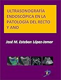 Ultrasonografía endoscópica en la patología del recto y ano (Este capítulo pertenece al libro Tratado de ultrasonografía abdominal)