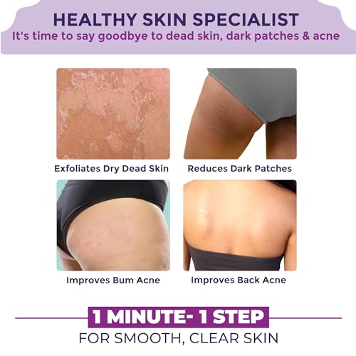 Sanfe Back & Bum Cream for Dark Spots and Body Acne | Glycolic Acid, Lactic Acid & Urea | 11% AHA & Maximum Exfoliation | Remove Dead Skin for Women | 100gm - Image 6