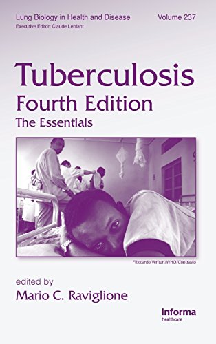 Tuberculosis: The Essentials, Fourth Edition (Lung Biology in Health and Disease)