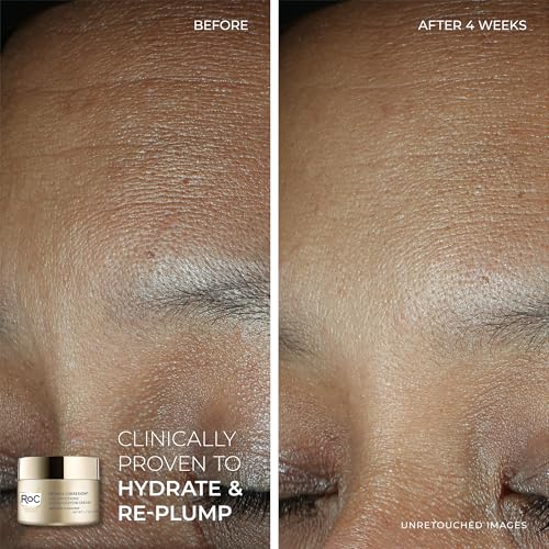 RoC Retinol Correxion Line Smoothing Eye Cream + Retinol Serum Capsules For Night + Max Hydration Crème With Hyaluronic Acid For Day, Skin Care Routine for Women and Men - image 3