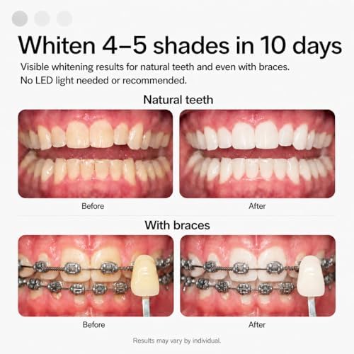 Opalescence GO 15 Whitening Bundle - (7 Treatments) Hydrogen Peroxide Prefilled Teeth Whitening Trays and Travel Sensitive Whitening Toothpaste 1 Oz - Mint Flavor- Includes a Toothbrush - 6288-1T - 3
