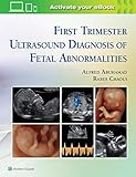 First Trimester Ultrasound Diagnosis of Fetal Abnormalities