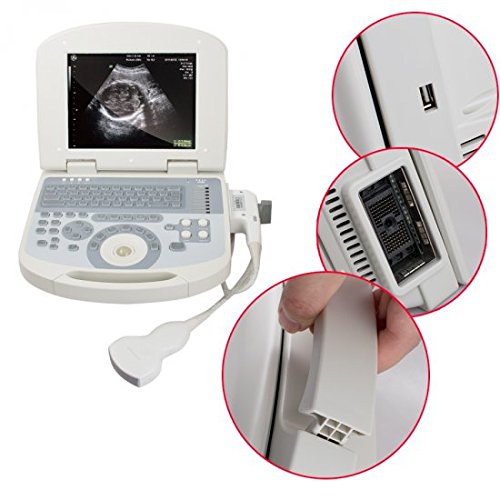 Zinnor Portable 10.4 inch Full Digital Laptop Scanner Machine with 3.5MHz Probe(DHL Shipping)