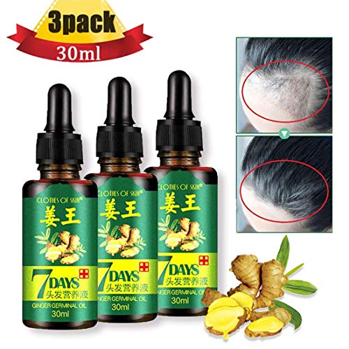 3 PACK Ginger Germinal Oil ,2020 Hair Growth Ginger Essential Oil Hair Growth Oil Hair Loss Treatment For Women and Men