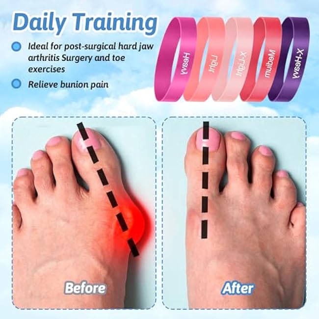Toe Bands Big Toe Spacers for Bunion Correction Portable Loop Resistance Bands for Stretching Yoga Exercise