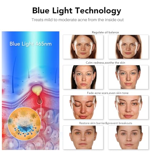 NEWKEY Blue light Therapy Mask for Face Acne, 7 Colors LED Acne Scar Spots Light Therapy Treatment with Silicone Eye Protector for Acne Prone Sensitive Skin and Blemishes Prevention,Plug-in - Image 4