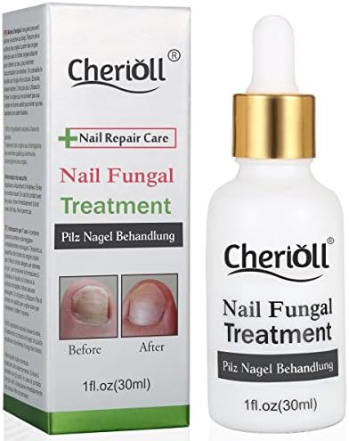 Nail Antifungal Treatment,Nail Fungus Treatments,Anti Fungus Nail Treatment,Fungus Stop,Effective Against Nail Fungus,Restores Toenail Fungus