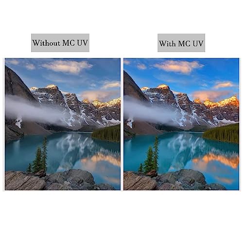 Kit de accesorios para lente Sigma 72 mm art - Fernando Cortés Kit de accesorios para lente Sigma 72 mm art - Fernando Cortés