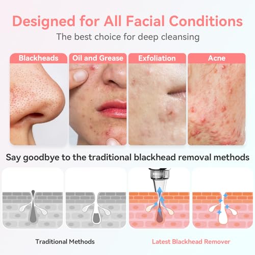 Freeshow JHF-15 Newest Blackhead Remover Pore Vacuum Upgraded Facial Pore Cleaner Electric Comedone Whitehead Extractor Tool-5 Suction Power,5 Probes,Usb Rechargeable Blackhead Vacuum Kit thumb #2