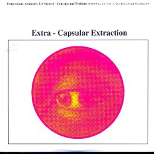 Earth Extra Capsular Extraction Vinyl Amazon Music
