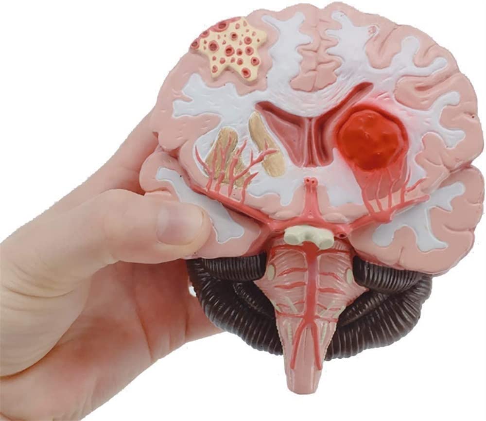 Tryb Nauczania Anatomii, Tryb Montażu Chorób Mózgu Ludzkiego, Tryb Anatomii Neurochirurgii, Tryb Nauczania Patologii Krwotoków Mózgowych