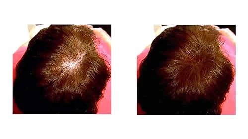 Miniatura 6 de Fibra capilar para adelgazar el cabello. Hace que el cabello fino se vea 10 veces más completo, cubre las calvas al instante. Fibra engrosadora del