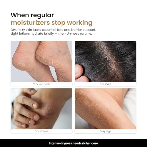 Image of Personal Touch Intenseal Shea Butter Balm | 92% Pure Shea Butter | Deep Moisturizing Body Balm for Intense Dry & Very Dry Skin | With Almond Oil & Vitamin E | Non-Greasy | 50 ml
