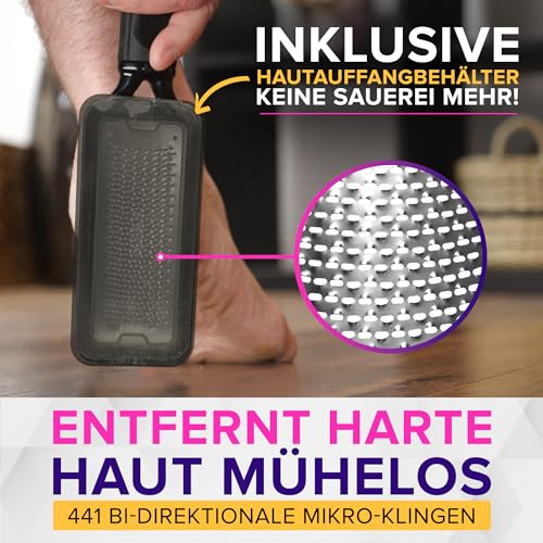NYK1 ULTIMATIVE Hornhautfeile Hornhautentferner Für Fußpflege | Groß – Ansicht 3