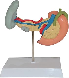 Pancreas Model Duodenum Model Human Organ Anatomy Model Diseased Pancreas， Spleen， Liver， Gallbladder and Duodenum Model for Teaching Study Medical Modeluseful SaiFei