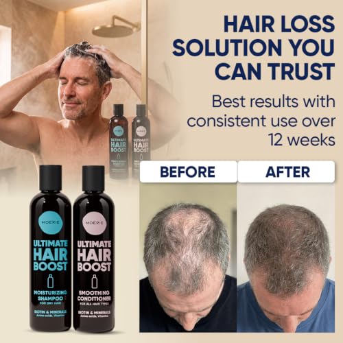 Image of Moerie Ultimate Hair Growth Shampoo & Conditioner Double Set - Longer, Thicker, Fuller Hair - Vegan, Volumizing, Paraben & Silicone Free - Moisturizing for All Hair Types - 4 x 8.45 fl oz (250ml)