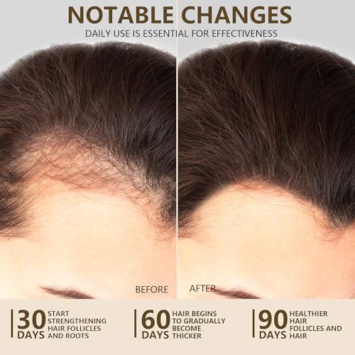 Image of 100% Natural Raw Batana Oil for Hair Growth, Unrefined & Organic Dr Sebi Hair Growth Oil From Honduras, Prevents Hair Loss, Eliminates Split Ends, Enhances Thickness 5.07 Fl Oz (Pack of 2)