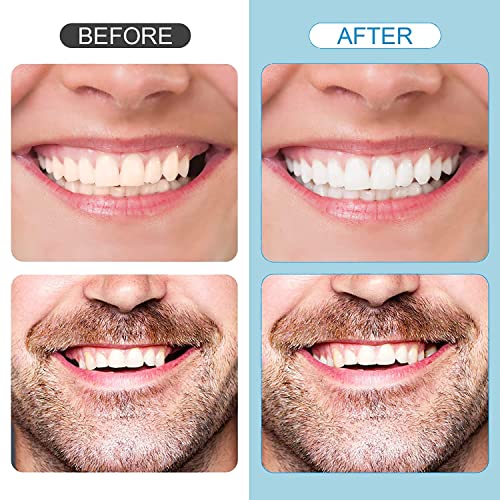 Tooth Repair Kit，Temporary Natural Shade Fake Teeth For Filling The Gap, Moldable Fake Teeth And Thermal Beads Replacement Kit Replace The Missing Or Broken Tooth-6Pcs（D-3) #TOP6