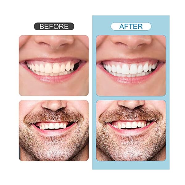Temporary Fake Teeth, Tooth Repair Kit, Natural Shade Fake Teeth