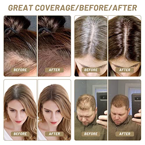 Sovoncare Instantly Hairline Powder, Hairline Shadow Gray Hair Coverage Touch Up Hair Powder For Thinning Hair For Women Hair Root Touch Up Powder Hair Root Cover Up Conceals Hair Loss Thin Hair Cover Powder Light Auburn #TOP1
