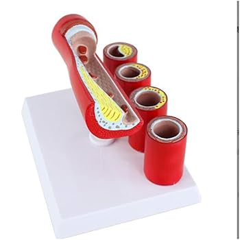 Amazon.co.jp: 人間の血管モデル - 人間の教育病理学的血管解剖