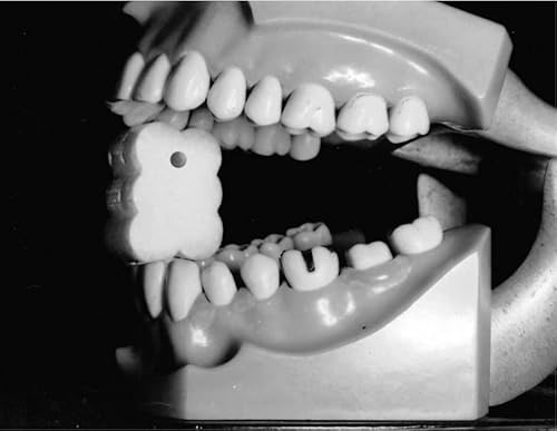 Ez-Prop RT-EZPROP Ez Prop ® Disposable Mouth Prop thumb #6