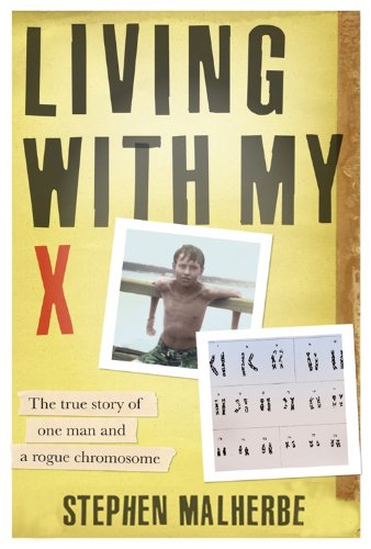Living with my X
